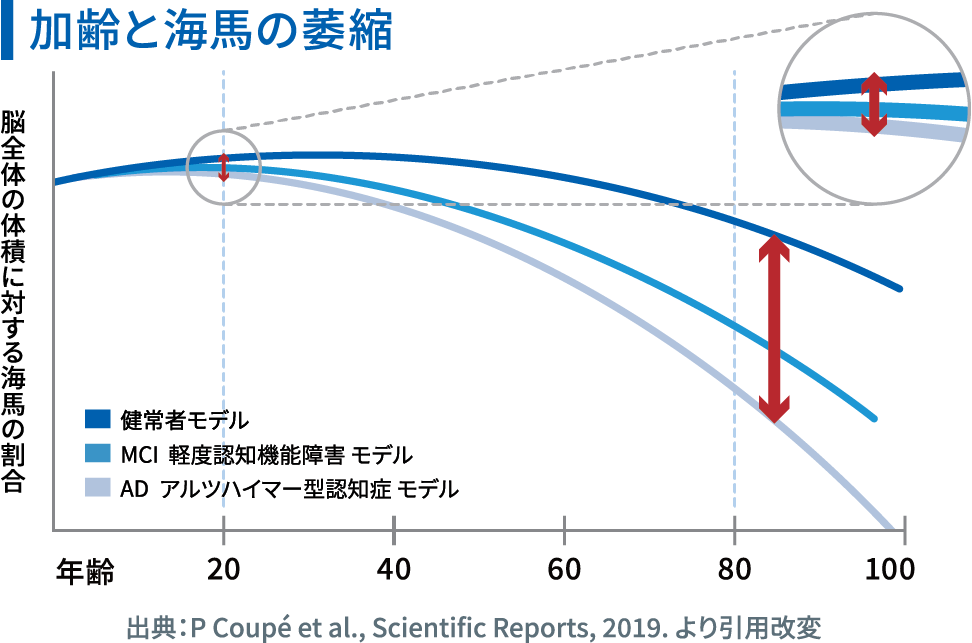 加齢と海馬の萎縮